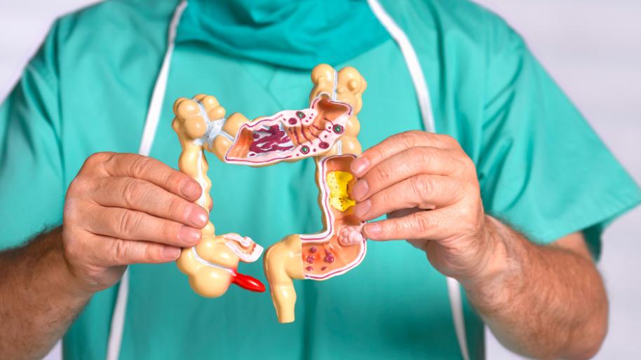 Doctor holding model large intestine