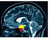 The Hypothalamus stimulates the Pituitary gland which stimulates Adrenal gland = CORTISOL. 