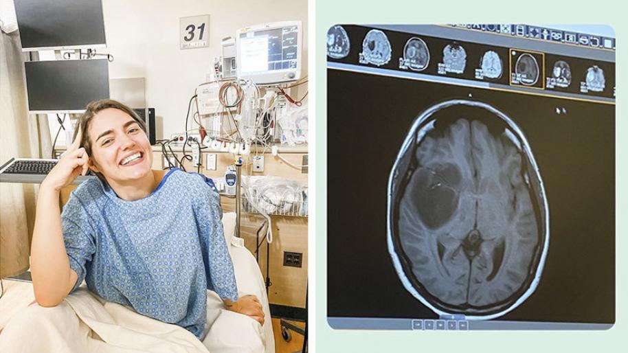Smiling white woman wearing hospital gown with hospital equipment behind and image of brain 